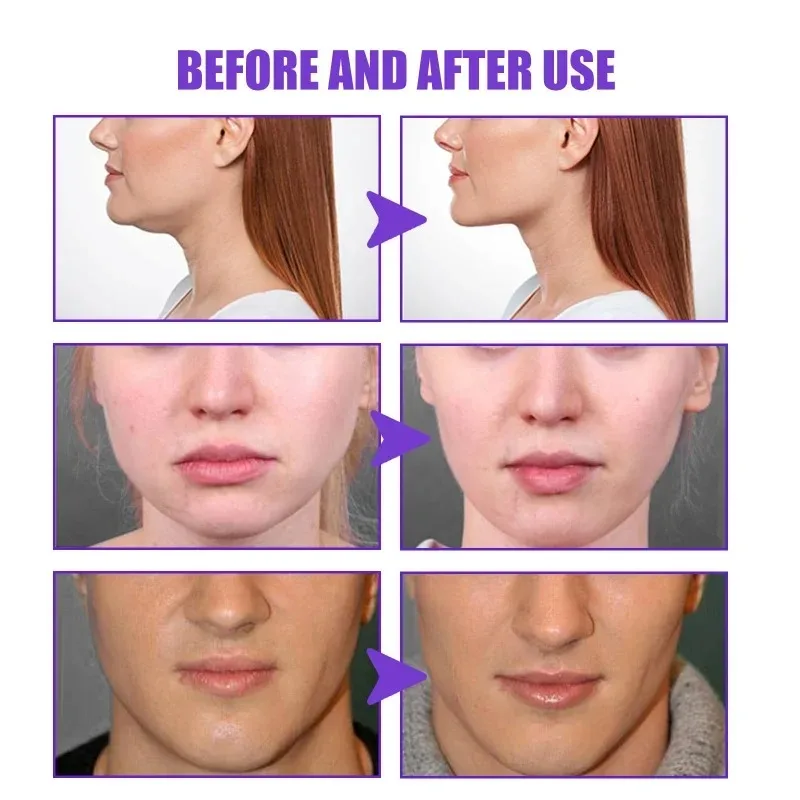 Crema adelgazante de estiramie - Anti-Aging Face Cream reseña y precio